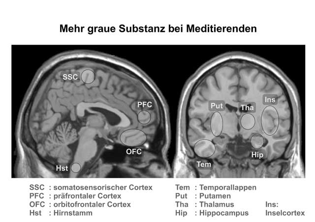 tv47-ott-meditation-06